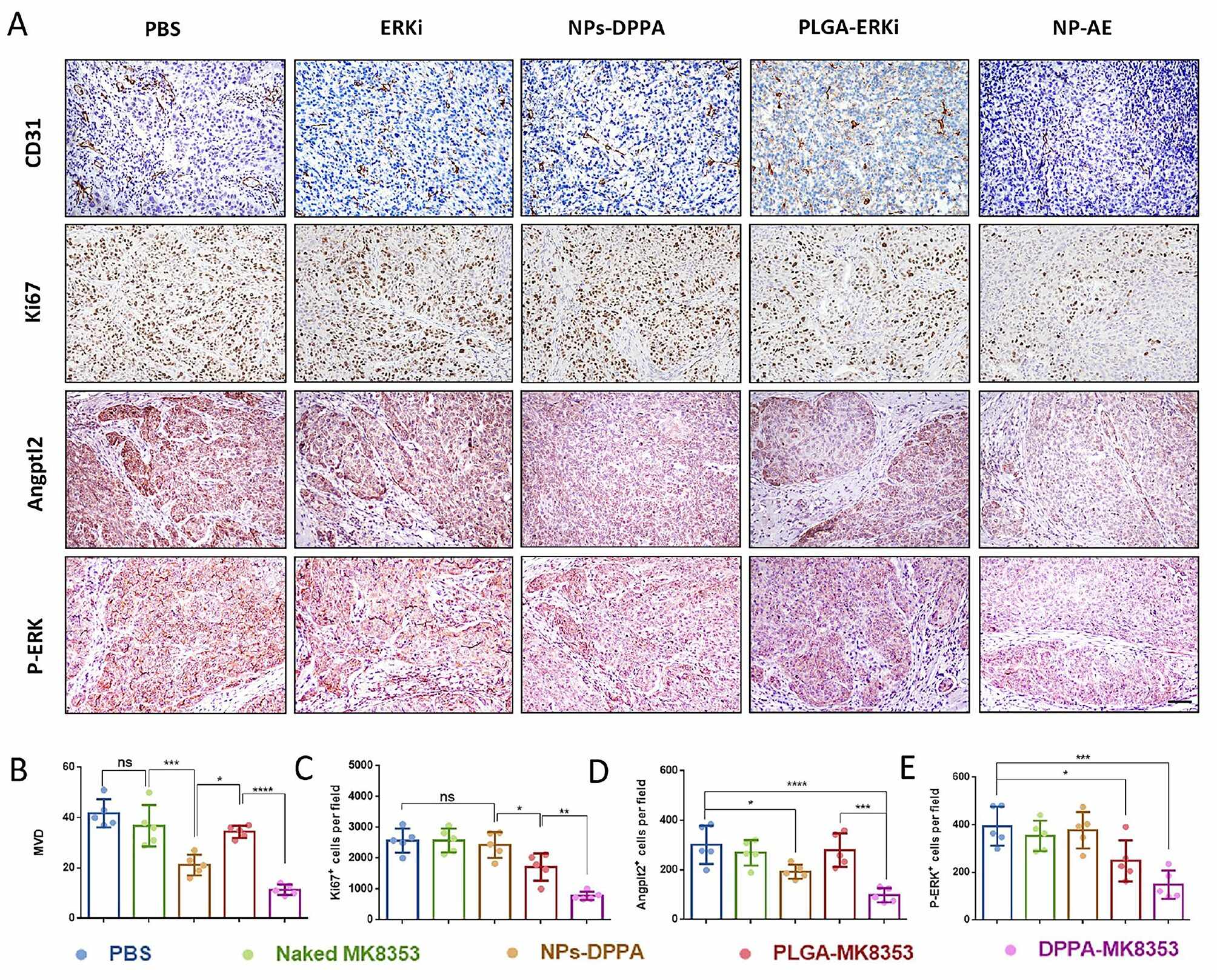 图6 瘤内IHC与定量:CD31/MVD、Ki67、Angptl2、P-ERK四项同降